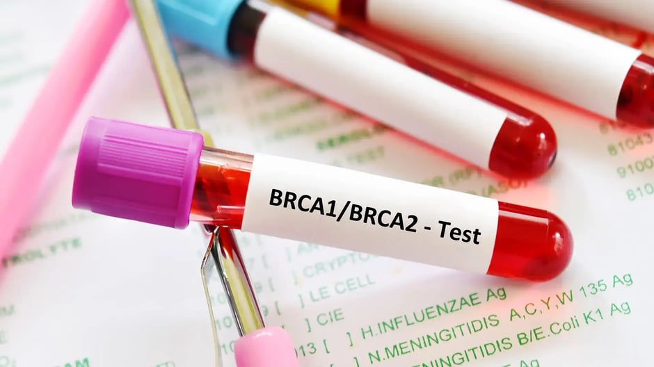Blood sample for BRCA1 and BRCA2 test, gene marker for breast cancer