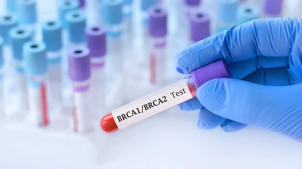 Doctor holding a test blood sample tube with BRCA1 and BRCA2 test on the background of medical test tubes with analyzes