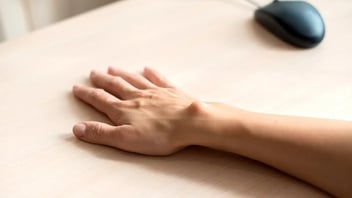 Hand resting on table with a cyst on wrist